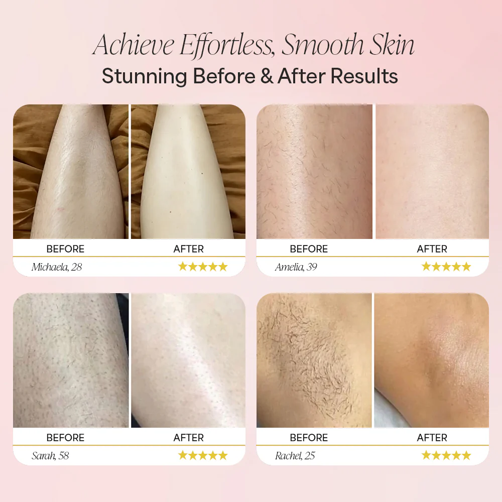 Dermave™ Electric Trimmer 2.0 - Image 3