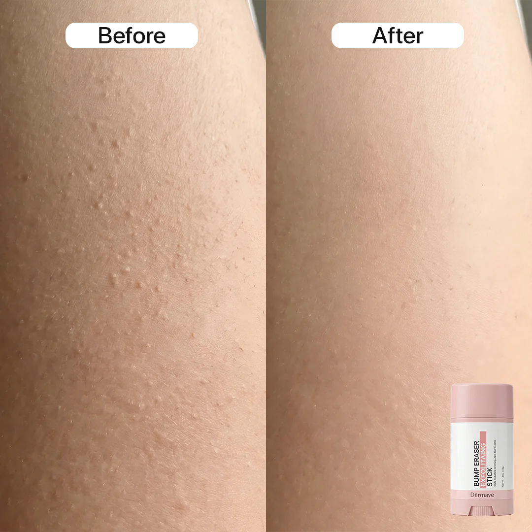 Dermave™ Full Routine Bundle - Image 3