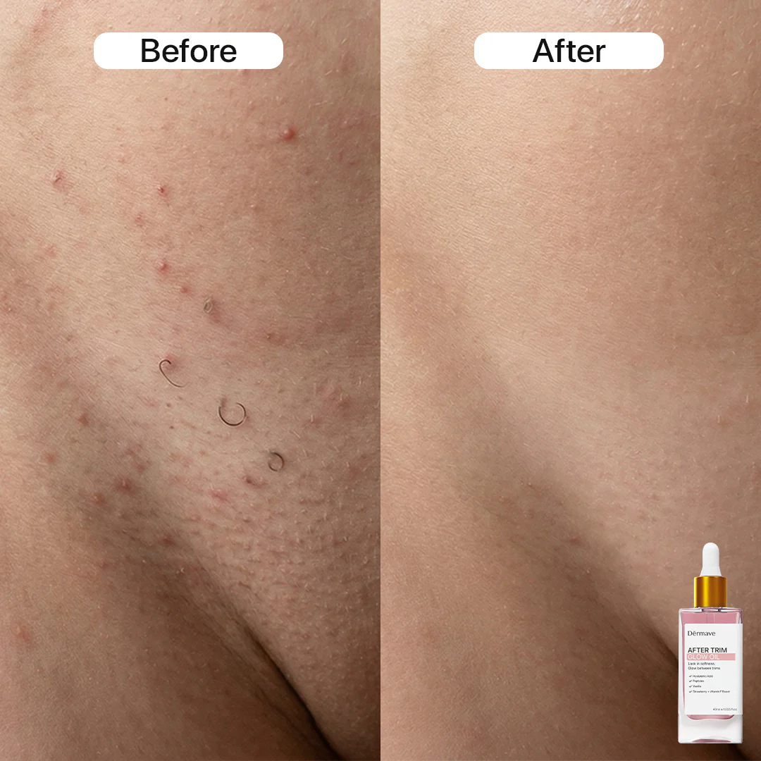 Dermave™ Full Routine Bundle - Image 4