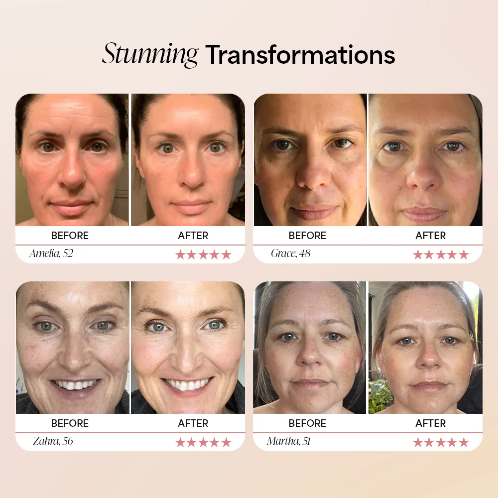 Dermave™ Deep Collagen Mask - Image 2