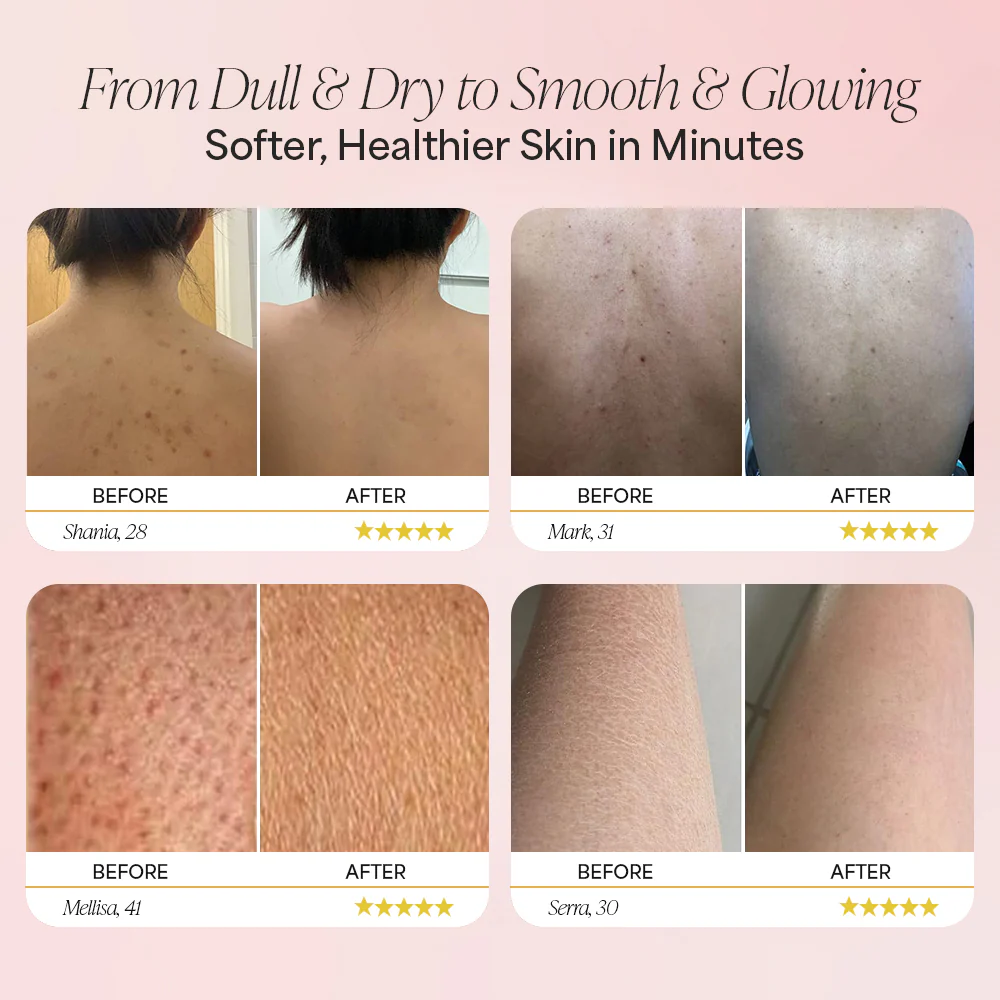 Dermave™ African Exfoliating Scrubber - Image 2